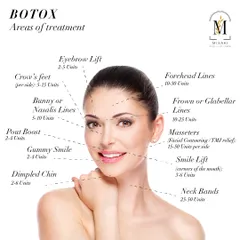 This diagram illustrates the many areas where Botox can be used for facial enhancement. From an eyebrow lift to softening a dimpled chin or smile lines, it is a versatile tool for subtle, targeted improvements.