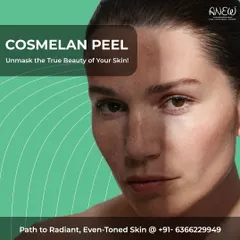 Unmask the true beauty of your skin with the Cosmelan Peel. This powerful, results-driven treatment is for anyone suffering from unwanted pigmentation, effectively tackling melasma and sun damage to reveal a radiant, even-toned complexion.