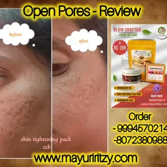 Many of you ask me about open pores, and here is the result you can expect. This is a real customer's 'before and after' photo after using my skin tightening pack. You can see how the pores have visibly reduced, making the skin look smoother and clearer.