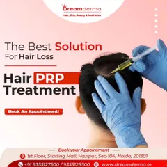 Here is a close-up of a Hair PRP treatment session. I am carefully administering the platelet-rich plasma directly into the scalp's dermal layer. This targeted approach ensures the growth factors reach the hair follicles where they are needed most to stimulate growth.