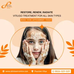 My goal is to help you restore, renew, and radiate confidence. I offer vitiligo treatments for all skin types because every person deserves to feel comfortable and shine.
