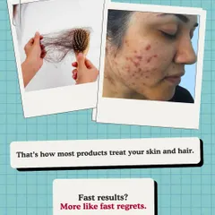 Many over-the-counter products promise fast results but can lead to long-term damage. This visual contrasts the harsh effects of improper treatments with our philosophy of science-backed, gentle care for sustainable skin and hair health.
