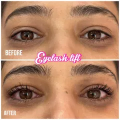 This before and after shows the magic of a lash lift. This service is perfect if you want to enhance your natural lashes without extensions. I curl your own lashes from the root, giving them a lifted, longer appearance that lasts for over a month.