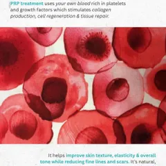 This is a microscopic look at what makes PRP so effective. The treatment harnesses your blood's platelets and growth factors to stimulate cell regeneration and tissue repair. For hair, this means waking up lazy follicles and improving the overall health of your scalp ecosystem.