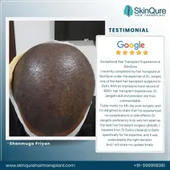 Shanmuga Priyan traveled from Dublin, Ireland, specifically for my expertise. He shares his 5-day post-surgery experience, noting no complications and praising my skill and precision. His trust is a testament to our global reputation.