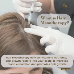 Hair mesotherapy is a targeted treatment where I deliver a specialized cocktail of vitamins, nutrients, and growth factors directly to the scalp's mesoderm. This technique nourishes the hair follicles, improves local blood circulation, and is highly effective for enhancing hair density and vitality.