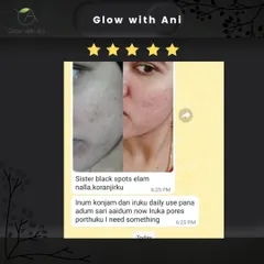 "Black spots ellam nalla koranjirku" (The black spots have reduced a lot). This is the kind of message that makes my day. Seeing my products help clear up skin concerns is my goal.
