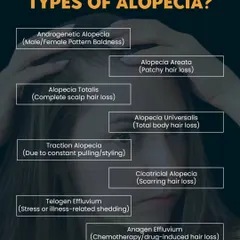 There are many types of alopecia. This graphic explains the differences between conditions like Androgenetic Alopecia, Alopecia Areata, and Telogen Effluvium.