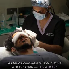 A hair transplant is a meticulous surgical procedure that restores not just hair, but confidence. This image captures our surgeon during an FUE transplant, focusing on creating a natural-looking hairline for a permanent solution to hair loss.