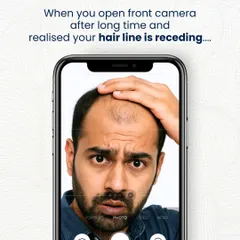 That moment when the front camera opens and you see your receding hairline is a wake-up call for many. But you don't have to live with it. Our expert hair restoration can bring back your natural hairline and your confidence.