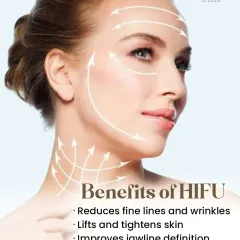The benefits of a HIFU treatment are significant. It reduces fine lines and wrinkles, lifts and tightens sagging skin, and improves jawline definition, all while delivering natural-looking results.