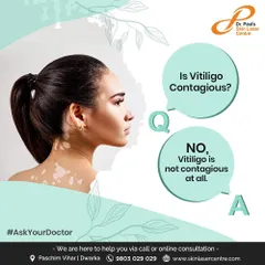 I am often asked if vitiligo is contagious. The answer is simple: no, it is not contagious at all. It is an autoimmune condition, not an infection, and it cannot be spread through any form of contact.