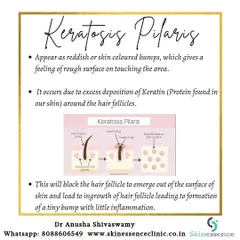 Keratosis Pilaris occurs when excess keratin, a natural skin protein, builds up and blocks hair follicles. This blockage leads to the formation of tiny bumps and can cause some inflammation around the follicle.
