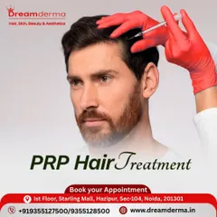 This image demonstrates the application of PRP hair treatment for men experiencing hair thinning. The procedure is precise and focuses on areas of concern to help restore hair density and strength.