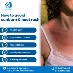 This guide shows you how to avoid sunburn and heat rash. Key steps include using SPF daily, staying shaded during peak sun hours, and wearing breathable cotton fabrics.
