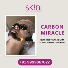 The Carbon Miracle treatment is another name for my Carbon Laser Facial. It's a non-invasive procedure I recommend for anyone looking to deeply cleanse, exfoliate, and rejuvenate their skin for a youthful glow.
