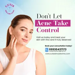 Don't let acne take control of your confidence. We provide the professional care your skin deserves, with personalized treatment plans designed by our expert dermatologists to help you achieve and maintain clear skin.