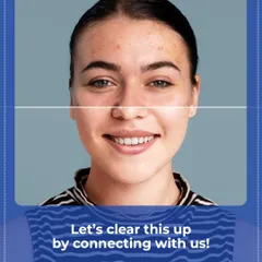 A side-by-side comparison showing the journey from active breakouts to clear, healthy skin. Let's work together to clear this up and restore your confidence.