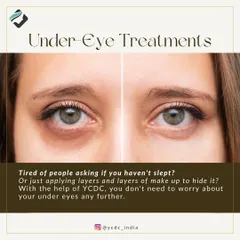 Tired of looking tired? We offer a range of under-eye treatments to address dark circles, whether they are caused by genetics, hyperpigmentation, or volume loss.