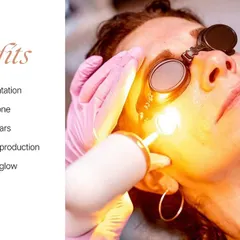 The ADVATx laser is a key tool for bridal preparation. As shown here, its benefits include reducing pigmentation, evening out skin tone, fading acne scars, and boosting collagen for an instant glow.
