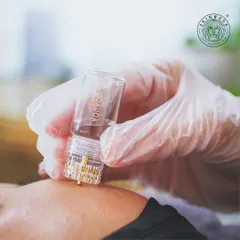 A close-up of the Aquagold Fine Touch device. This celebrity-approved treatment uses 24K gold micro-channels to infuse a personalized cocktail of hyaluronic acid and vitamins for an intense, event-ready glow.