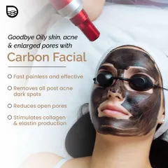 The Carbon Laser Peel is an effective solution for persistent oily skin, acne, and enlarged pores. This image shows the treatment in progress, which uses a carbon mask and laser to remove dark spots, reduce pore size, and stimulate collagen for lasting results.