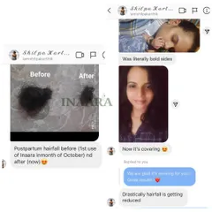 Here is another look at the reality of postpartum hair fall and the recovery possible with the right care. The image on the left shows the amount of hair fall she experienced, which was drastically reduced after using my products.