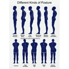 Your posture has a huge impact on your overall health. This chart illustrates various postural problems, such as a hollow back, high hip, or severe scoliosis, which we can help correct through targeted physiotherapy.