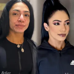 For skin with active acne, my process is all about careful skin prep and precise application. This transformation shows how I achieve a smooth, full-coverage base that looks natural and feels comfortable, without irritating the skin.