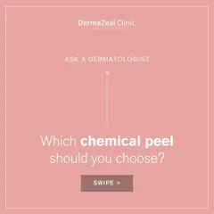 With several types of chemical peels available, it's important to choose the right one. This guide helps you start to understand the options, but a consultation will determine the perfect fit for your skin.
