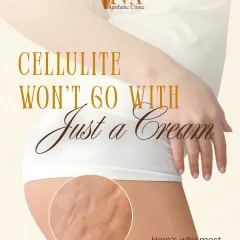 Many people believe cellulite will go away with just a cream, but it's a structural issue. This series explains why most home treatments fail and how professional assessment is key.