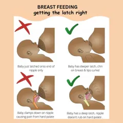 A proper latch is key to successful breastfeeding for both mother and baby. This clear visual guide shows the difference between a shallow, painful latch and a deep, effective one, ensuring your baby gets enough milk and you remain comfortable.