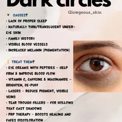 Dark circles are not just about lack of sleep. They can be caused by genetics, thin skin showing blood vessels, or volume loss creating shadows. I use a combination of treatments like brightening eye creams, lasers to reduce pigment, and tear trough fillers to correct hollowness for truly brighter eyes.