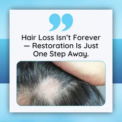 Seeing thinning patches can be discouraging, but hair loss isn't forever. Restoration is just one step away. We specialize in safe, effective treatments like MHI Transplant and PRP Therapy to stimulate natural regrowth and restore a healthy scalp, with natural-looking results.