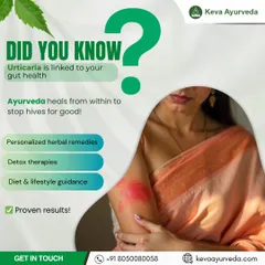 Did you know recurring hives, or Urticaria, are often linked to your gut health? We go beyond surface-level treatments to heal from within, using detox therapies and personalized remedies to stop flare-ups for good.
