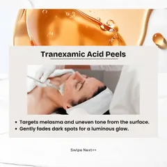 Tranexamic Acid Peels are excellent for surface-level concerns like melasma and uneven tone. This gentle peel effectively fades dark spots to reveal a luminous glow.