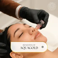 A client receiving the Aquagold Fine Touch treatment. This micro-infusion therapy is ideal for achieving that perfect bridal glow, delivering nutrients directly into the skin for unparalleled radiance.