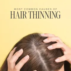 Hair thinning is a complex issue with multiple potential causes. My process always begins with a thorough assessment to understand the specific factors affecting you, ensuring that the subsequent treatment is correctly targeted for the best results.