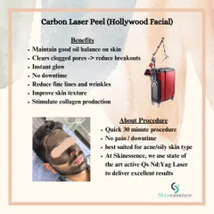 This infographic outlines the benefits of the Carbon Laser Peel. It's a quick, 30-minute procedure with no downtime that helps balance oil, clear pores, reduce fine lines, and gives an instant glow, making it ideal for oily or acne-prone skin.