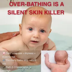 A common mistake I see parents make is over bathing their babies. An infant's skin is extremely delicate and requires a different approach than adult skin. Using the wrong products or bathing too frequently can lead to dryness, eczema, and rashes.