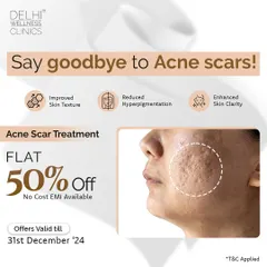 An offer graphic highlighting a 50% discount on our comprehensive acne scar treatments, designed to improve skin texture and clarity.