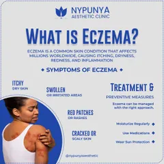 Eczema is a common condition causing itchy, dry, and inflamed skin. It can be managed with the right approach, which includes regular moisturizing, using prescribed medications, and consistent sun protection.