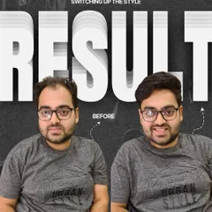 This graphic perfectly captures the confidence boost that comes with our non-surgical hair replacement systems. For this client, we designed a custom hairpiece that integrates flawlessly with his existing hair, restoring his hairline and creating a fuller, more youthful appearance.