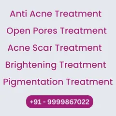 A simple, text-based image listing some of my core services: Anti Acne Treatment, Open Pores Treatment, Acne Scar Treatment, Brightening Treatment, and Pigmentation Treatment.