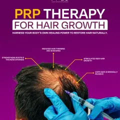 This shows how our PRP Therapy for hair growth works. It is a 100% safe and minimally invasive procedure that uses your body's own healing power to strengthen roots, reduce hair thinning, and stimulate new, natural hair growth.