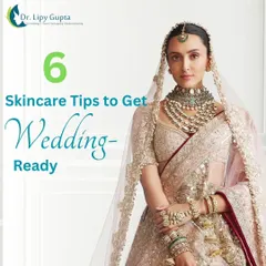 Here are my top skincare tips to get wedding-ready. Achieving glowing skin for your big day is a marathon, not a sprint.