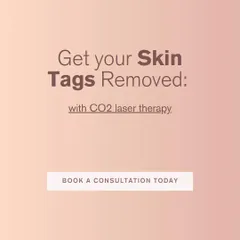 If you're ready to get your skin tags removed, CO2 laser therapy is an excellent, safe, and effective option. A consultation is the first step to achieving smoother skin.
