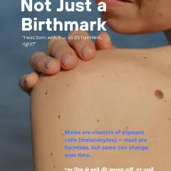 Even a birthmark or a mole you have had forever can change over time. While most are harmless clusters of pigment cells, any change warrants a professional dermatological examination.