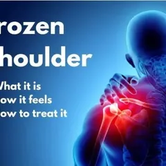 Frozen shoulder is a condition that causes significant stiffness and pain. This graphic outlines what it is, how it feels, and the treatment approaches I use to restore mobility and reduce discomfort.