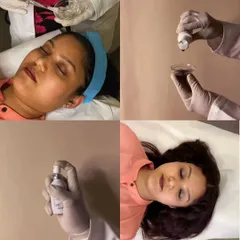 This collage showcases the key steps of a lip peel treatment, from preparing the peel solution to the careful application and post-treatment care, all designed to combat dryness and pigmentation.
